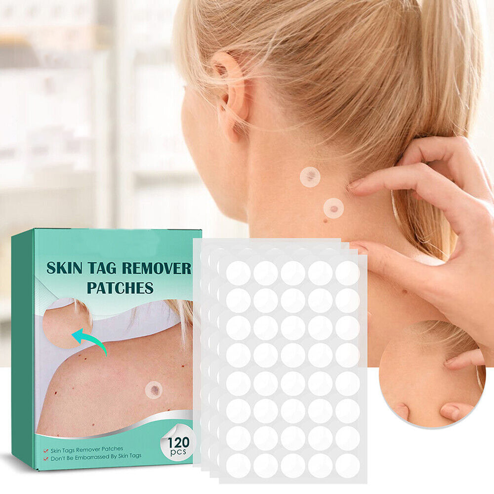 SkinClear Skin Tag & Blemish Patches - Pack of 120