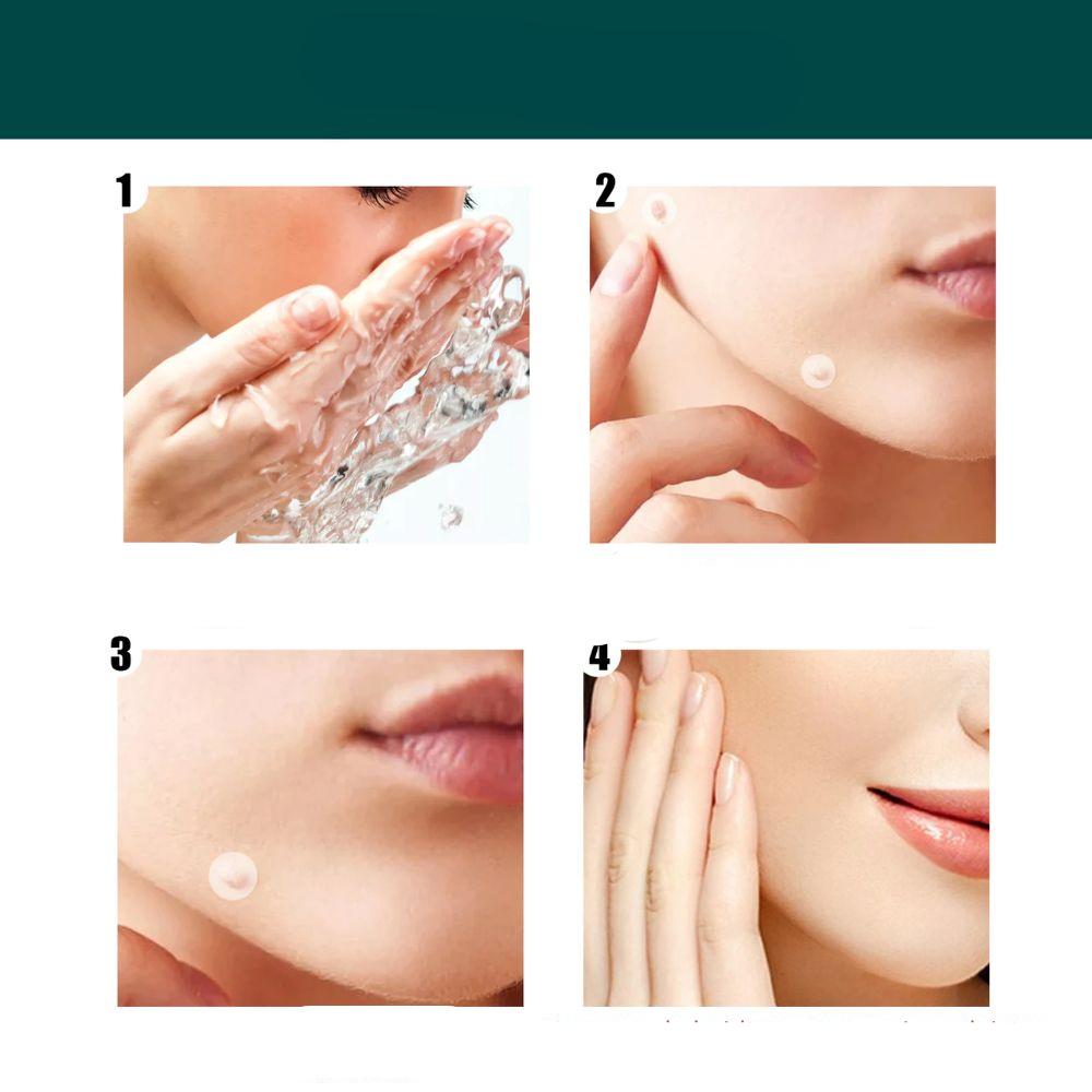 SkinClear Skin Tag & Blemish Patches - Pack of 120
