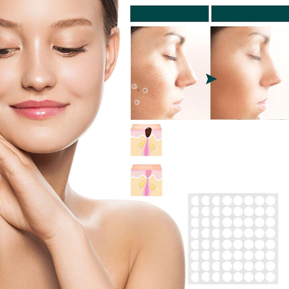 SkinClear Skin Tag & Blemish Patches - Pack of 120