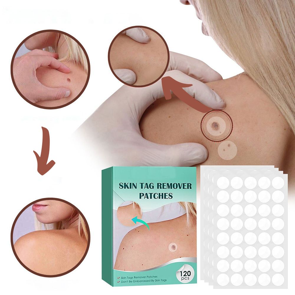SkinClear Skin Tag & Blemish Patches - Pack of 120