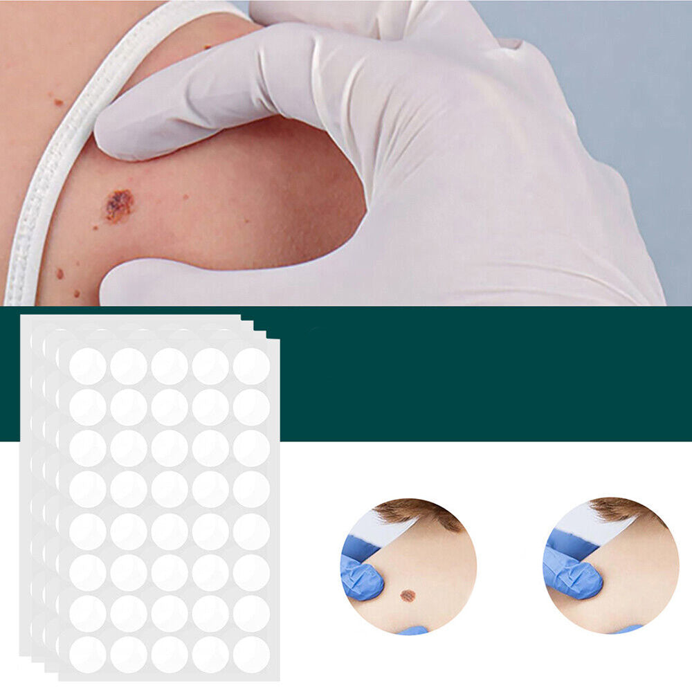 SkinClear Skin Tag & Blemish Patches - Pack of 120