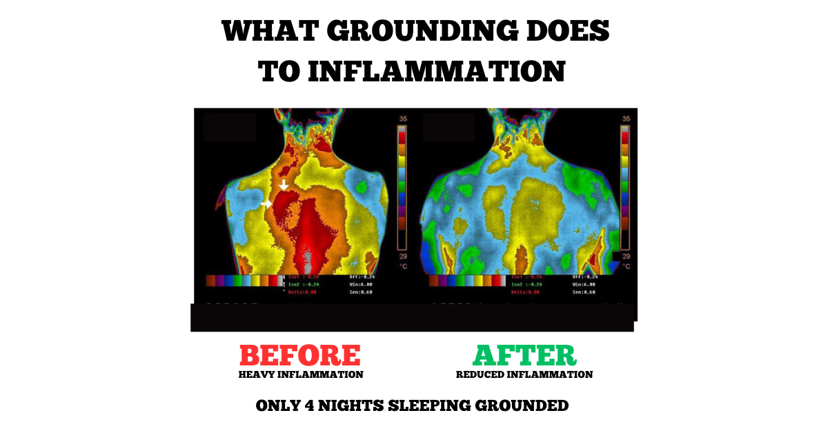 Earthing Grounding Sleep Mat for a Calmer Bedtime Routine